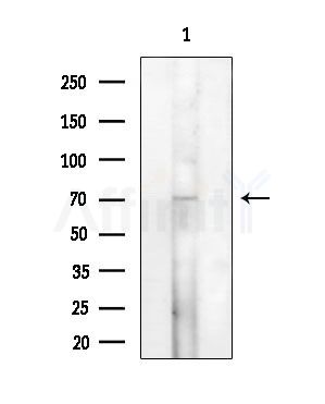 NOL4 Antibody - Western blot analysis of extracts from 3T3-L1 P6(heat-shock treatment), using NOL4 Antibody at 1/1000 dilution.