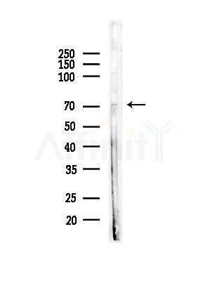 NOL4 Antibody - Western blot analysis of lysates from 3T3-L1 P6(heat-shock,45min treatment), using NOL4 Antibody at 1/1000 dilution.