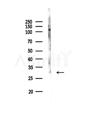 NOL7 Antibody - Western blot analysis of lysates from Rat brain, using NOL7 Antibody at 1/1000 dilution.