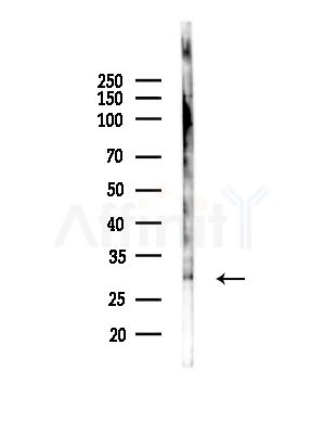 NOL7 Antibody - Western blot analysis of lysates from PC12 cells(LPS,4h treatment), using NOL7 Antibody at 1/1000 dilution.