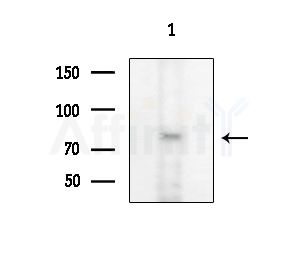 NOL9 Antibody - Western blot analysis of extracts from 3T3-L1 P6(heat-shock treatment), using NOL9 Antibody at 1/1000 dilution.