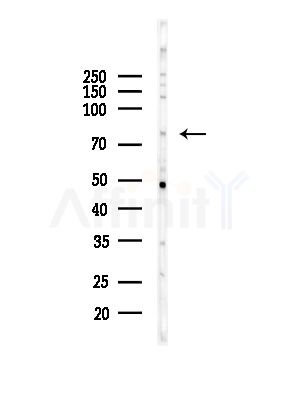 NOL9 Antibody - Western blot analysis of lysates from 3T3-L1 P6(heat-shock,45min treatment), using NOL9 Antibody at 1/1000 dilution.