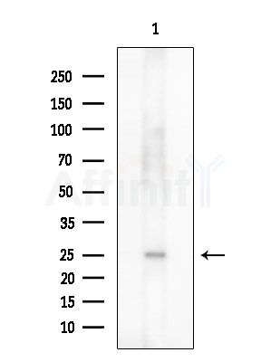 ZCCHC17 Antibody - Western blot analysis of extracts from HUVEC cells, using ZCCHC17 Antibody at 1/1000 dilution.