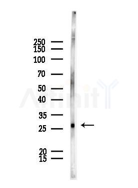 ZCCHC17 Antibody - Western blot analysis of lysates from HUVEC cells, using ZCCHC17 Antibody at 1/1000 dilution.