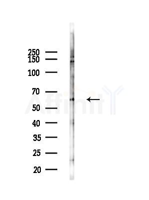 SLC22A4 Antibody - Western blot analysis of lysates from COLO205 cells(UV,30min treatment), using SLC22A4 Antibody at 1/1000 dilution.