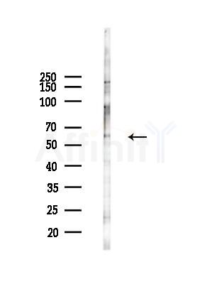 SLC22A4 Antibody - Western blot analysis of lysates from LoVo cells(heat-shock,45min treatment), using SLC22A4 Antibody at 1/1000 dilution.