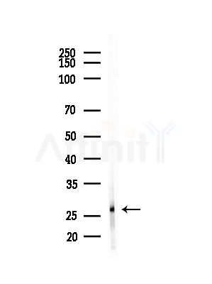 OAZ3 Antibody - Western blot analysis of lysates from B16F10-LUC cells(starvation,24h treatment), using OAZ3 Antibody at 1/1000 dilution.