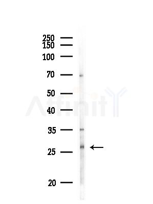 OAZ3 Antibody - Western blot analysis of lysates from MDA-MB-231 cells(heat-shock,45min treatment), using OAZ3 Antibody at 1/1000 dilution.