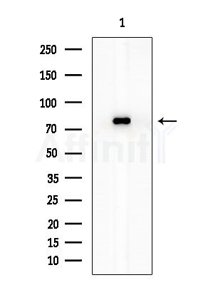 SLC6A17 Antibody - Western blot analysis of extracts from 3T3-L1 P6(heat-shock treatment), using SLC6A17 Antibody at 1/1000 dilution.
