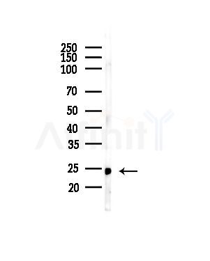 PRRX2 Antibody - Western blot analysis of lysates from COLO205 cells(heat-shock,45min treatment), using PRRX2 Antibody at 1/1000 dilution.