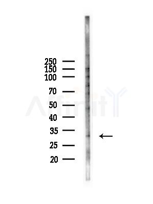 PHOX2B Antibody - Western blot analysis of lysates from A375 cells(starvation,24h treatment), using PHOX2B Antibody at 1/1000 dilution.