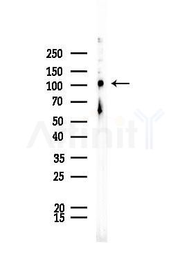 INPP5J Antibody - Western blot analysis of lysates from HUVEC cells, using INPP5J Antibody at 1/1000 dilution.