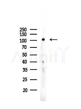INPP5J Antibody - Western blot analysis of lysates from COLO205 cells, using INPP5J Antibody at 1/1000 dilution.