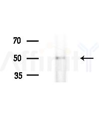 PIGW Antibody - Western blot analysis of extracts from Mouse brain, using PIGW Antibody at 1/1000 dilution.
