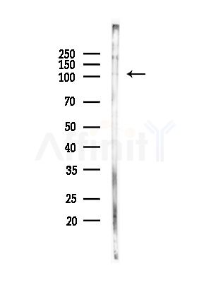 PLD2 Antibody - Western blot analysis of lysates from 3T3-L1 P6(heat-shock,45min treatment), using PLD2 Antibody at 1/1000 dilution.