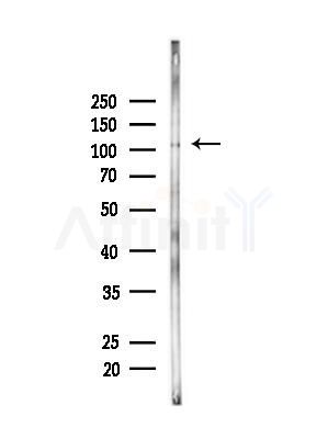 PLD2 Antibody - Western blot analysis of lysates from Hela cells(starvation,24h treatment), using PLD2 Antibody at 1/1000 dilution.