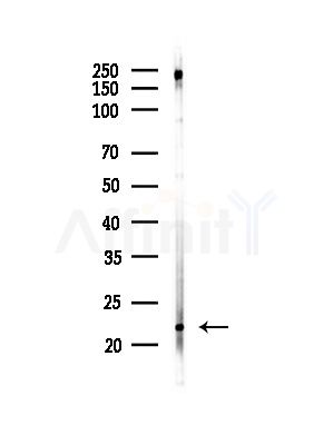 CD42c/GP1BB Antibody - Western blot analysis of lysates from Mouse brain, using CD42c/GP1BB Antibody at 1/1000 dilution.