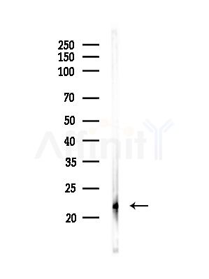 CD42c/GP1BB Antibody - Western blot analysis of lysates from Hela cells(starvation,24h treatment), using CD42c/GP1BB Antibody at 1/1000 dilution.