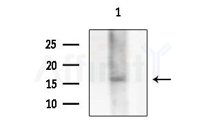 KCNE1L Antibody - Western blot analysis of extracts from Mouse testis, using KCNE1L Antibody at 1/1000 dilution.