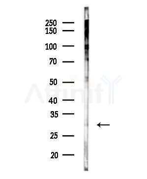 KCNE3 Antibody - Western blot analysis of lysates from COLO205 cells(heat-shock,45min treatment), using KCNE3 Antibody at 1/1000 dilution.