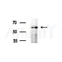 KCNS3 Antibody - Western blot analysis of extracts from various samples, using KCNS3 Antibody at 1/1000 dilution.