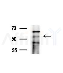 KCNS3 Antibody - Western blot analysis of extracts from various samples, using KCNS3 Antibody at 1/1000 dilution.