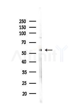 KCNS3 Antibody - Western blot analysis of lysates from HepG2 cells(LPS, 4h treatment), using KCNS3 Antibody at 1/1000 dilution.