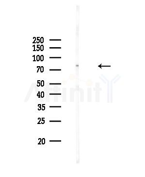HCN3 Antibody - Western blot analysis of lysates from Rat brain, using HCN3 Antibody at 1/1000 dilution.