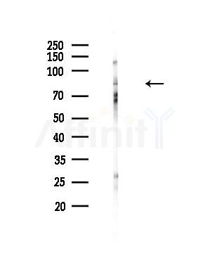 HCN3 Antibody - Western blot analysis of lysates from HepG2 cells(LPS,4h treatment), using HCN3 Antibody at 1/1000 dilution.