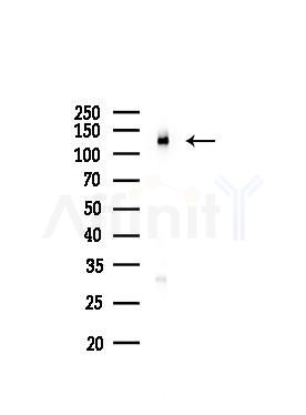 HCN4 Antibody - Western blot analysis of lysates from COLO205 cells, using HCN4 Antibody at 1/1000 dilution.