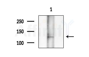 PRDM10 Antibody - Western blot analysis of extracts from 3T3-L1 P6(heat-shock treatment), using PRDM10 Antibody at 1/1000 dilution.
