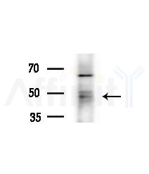 PBX4 Antibody - Western blot analysis of extracts from various samples, using PBX4 Antibody at 1/1000 dilution.