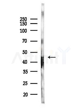 CLP1 Antibody - Western blot analysis of lysates from PC12 cells(LPS, 4h treatment), using CLP1 Antibody at 1/1000 dilution.