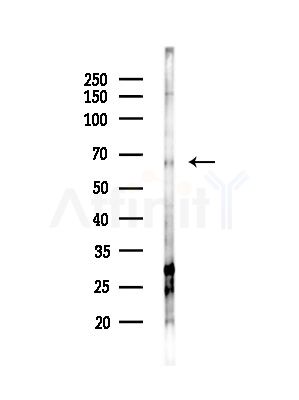 PRPF38B Antibody - Western blot analysis of lysates from HUVEC cells(starvation,24h treatment), using PRPF38B Antibody at 1/1000 dilution.