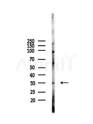 PPP1R3D Antibody - Western blot analysis of lysates from A375 cells(starvation,24h treatment), using PPP1R3D Antibody at 1/1000 dilution.