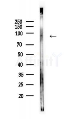 PPM1E Antibody - Western blot analysis of lysates from LoVo cells(heat-shock,45min treatment), using PPM1E Antibody at 1/1000 dilution.