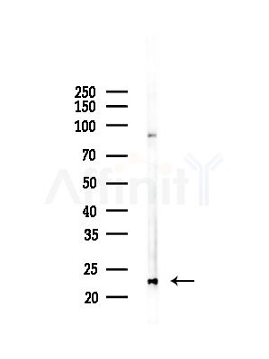 PPP1R2P3 Antibody - Western blot analysis of lysates from COLO205 cells(heat-shock,45min treatment), using PPP1R2P3 Antibody at 1/1000 dilution.