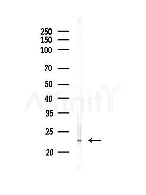PPP1R2P3 Antibody - Western blot analysis of lysates from Hela cells(starvation,24h treatment), using PPP1R2P3 Antibody at 1/1000 dilution.