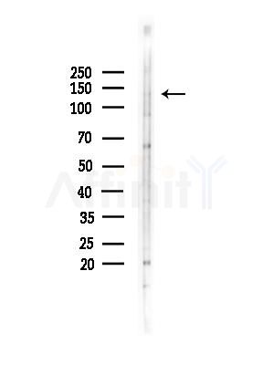 RAB11FIP1 Antibody - Western blot analysis of lysates from COLO205 cells(heat-shock,45min treatment), using RAB11FIP1 Antibody at 1/1000 dilution.