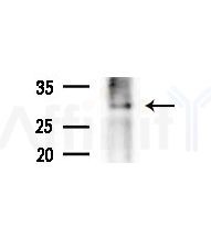 RABL2B Antibody - Western blot analysis of extracts from various samples, using RABL2B Antibody at 1/1000 dilution.