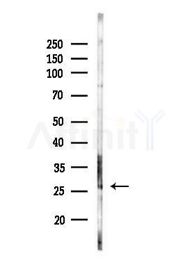 RABL2B Antibody - Western blot analysis of lysates from HepG2 cells(LPS, 4h treatment), using RABL2B Antibody at 1/1000 dilution.