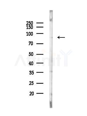 RGL1 Antibody - Western blot analysis of lysates from MCF7 cells(heat-shock,45min treatment), using RGL1 Antibody at 1/1000 dilution.