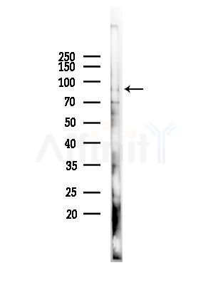 RASA4 Antibody - Western blot analysis of lysates from B16F10-LUC cells(starvation,24h treatment), using RASA4 Antibody at 1/1000 dilution.