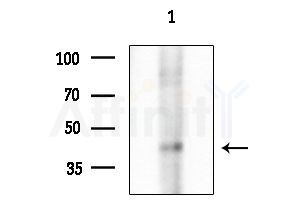 RASGEF1C Antibody - Western blot analysis of extracts from HepG2 cells(UV treatment), using RASGEF1C Antibody at 1/1000 dilution.