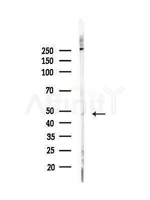 RASGEF1C Antibody - Western blot analysis of lysates from HepG2 cells(UV,30min treatment), using RASGEF1C Antibody at 1/1000 dilution.