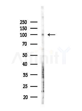 RASIP1 Antibody - Western blot analysis of lysates from HepG2 cells(LPS, 4h treatment), using RASIP1 Antibody at 1/1000 dilution.