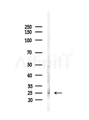 RERG Antibody - Western blot analysis of lysates from B16F10-LUC cells(starvation,24h treatment), using RERG Antibody at 1/1000 dilution.