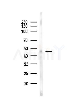 RRAGD Antibody - Western blot analysis of lysates from EC304 cells(heat-shock,45min treatment), using RRAGD Antibody at 1/1000 dilution.