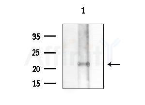 RAB15 Antibody - Western blot analysis of extracts from Mouse testis, using RAB15 Antibody at 1/1000 dilution.