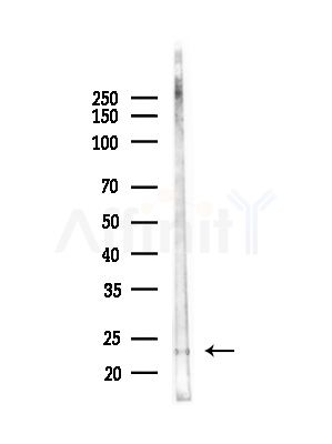 RAB15 Antibody - Western blot analysis of lysates from Mouse testis, using RAB15 Antibody at 1/1000 dilution.